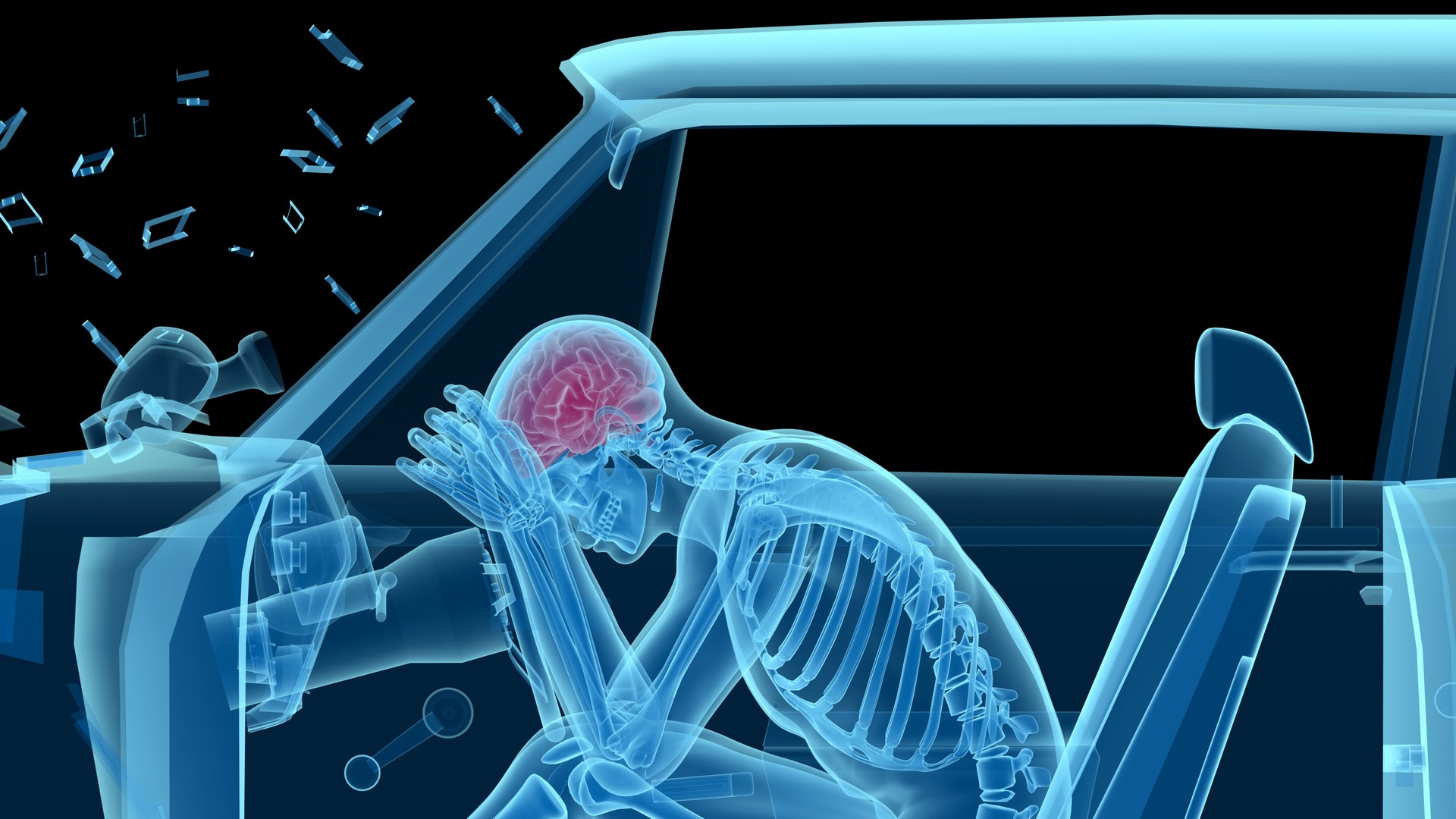 Human anatomy in a car crash, bones and brain